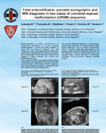 Fetal enterolithiasis, prenatal sonographic and MRI diagnosis