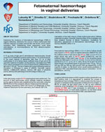 Fetomaternal haemorrhage in vaginal deliveries 