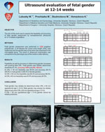 Ultrasound evaluation of fetal gender at 12-14 weeks